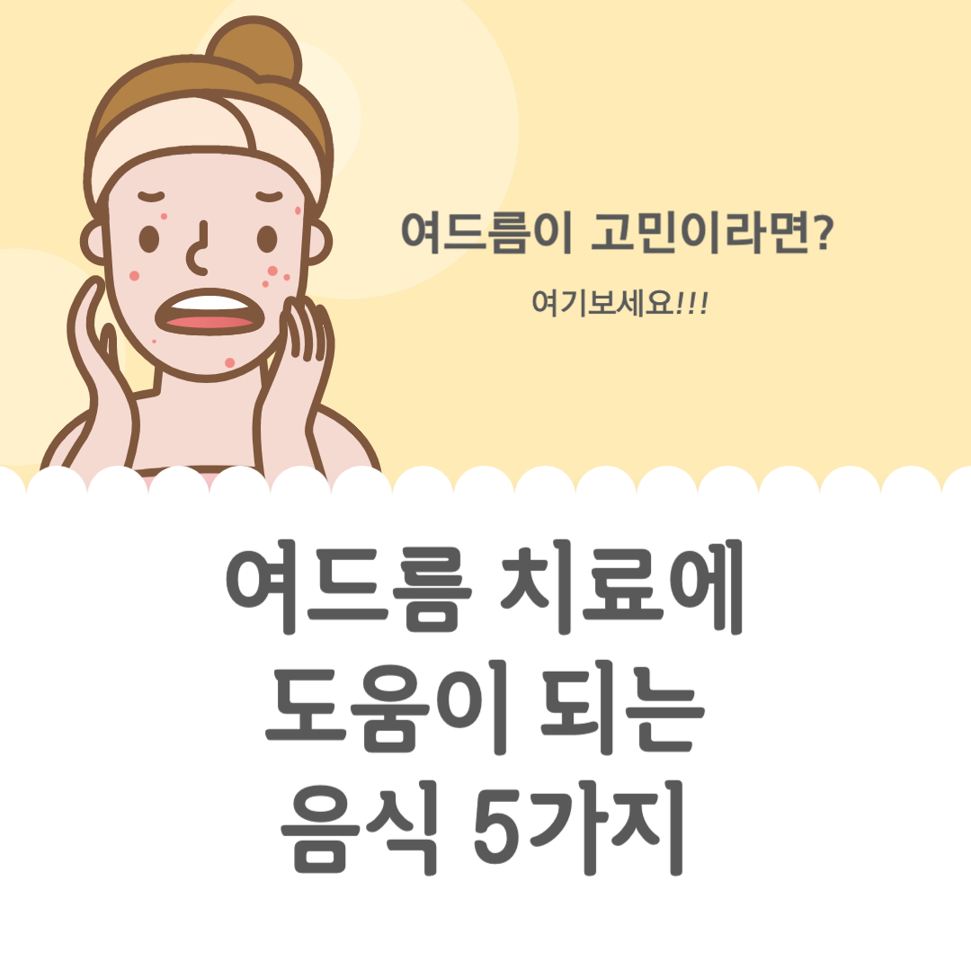 여드름 치료에 도움을 주는 음식 5가지