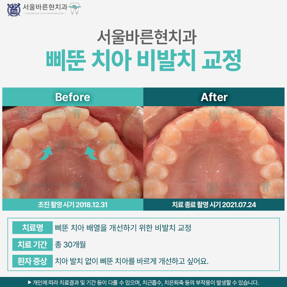 부산교정치과