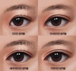 대구 쌍수