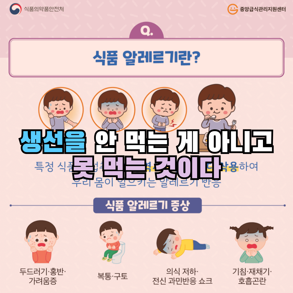 생선을 안 먹는 게 아니고 못 먹는 것이다: 식품알레르기