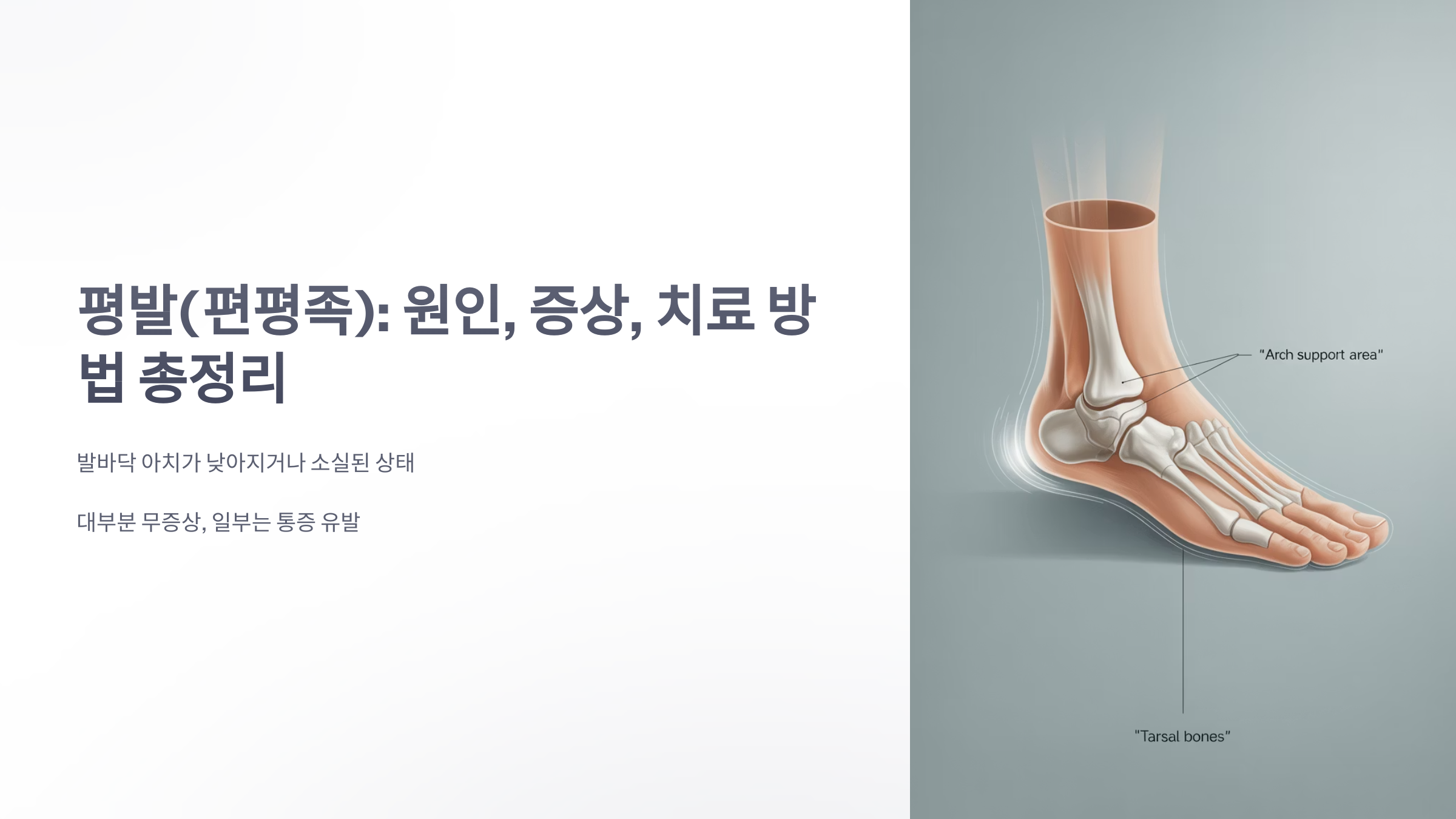참조-평발-1