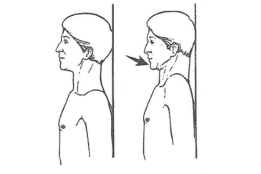 ▲ 경추 C곡선을 되살리는 기본 재활 동작인 턱 당기기(Chin-Tuck) 운동