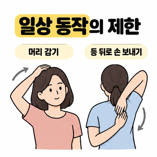 머리 감기와 등 뒤로 손 보내기 동작을 나란히 보여주며 일상 동작의 제한을 설명한 그림