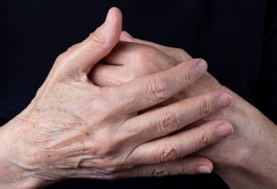 손등 핏줄 튀어나오는 이유