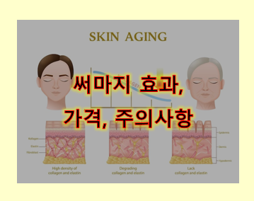 써마지 (Thermage) 시술의 필요성, 원리, 가격, 주의사항, 장점, 단점