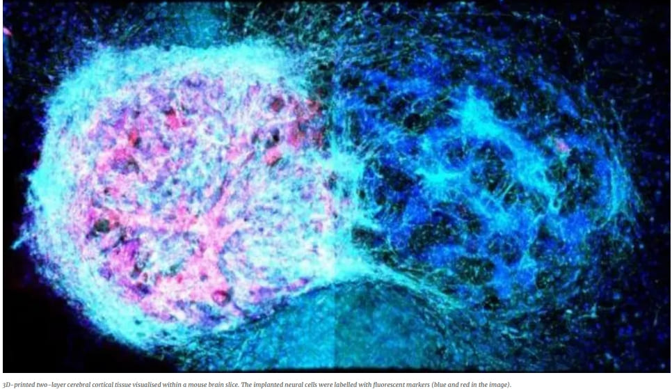 뇌&nbsp;손상&nbsp;치료 희망, 획기적인 새로운&nbsp;뇌 3D&nbsp;프린팅 기술: 옥스포드&nbsp;대 New 3D printing approach offers hope for brain injury repair