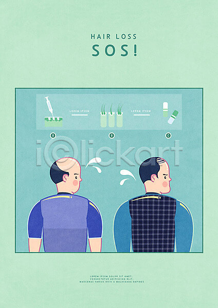 모발이식 부위별 비용