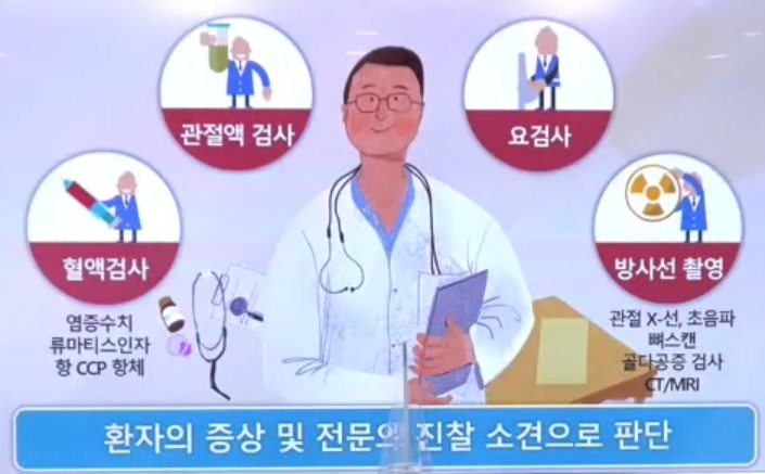 류마티스 관절염 진단 방법