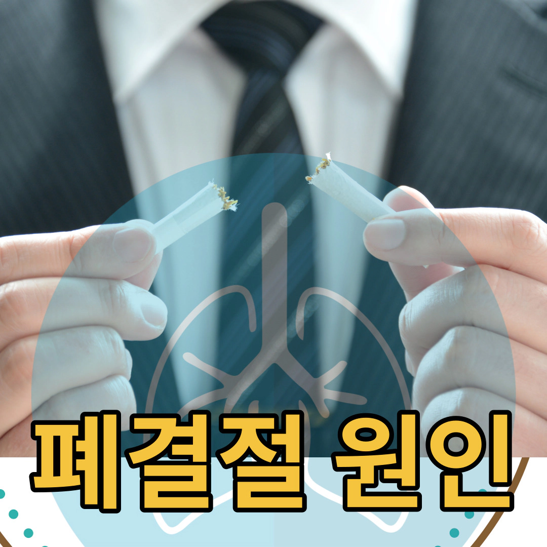 폐결절-원인-증상