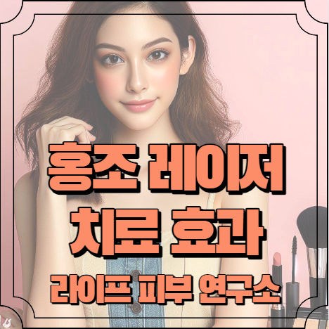 홍조 레이저 치료 효과 알아보기