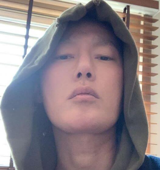 허지웅 악성림프종 혈액암