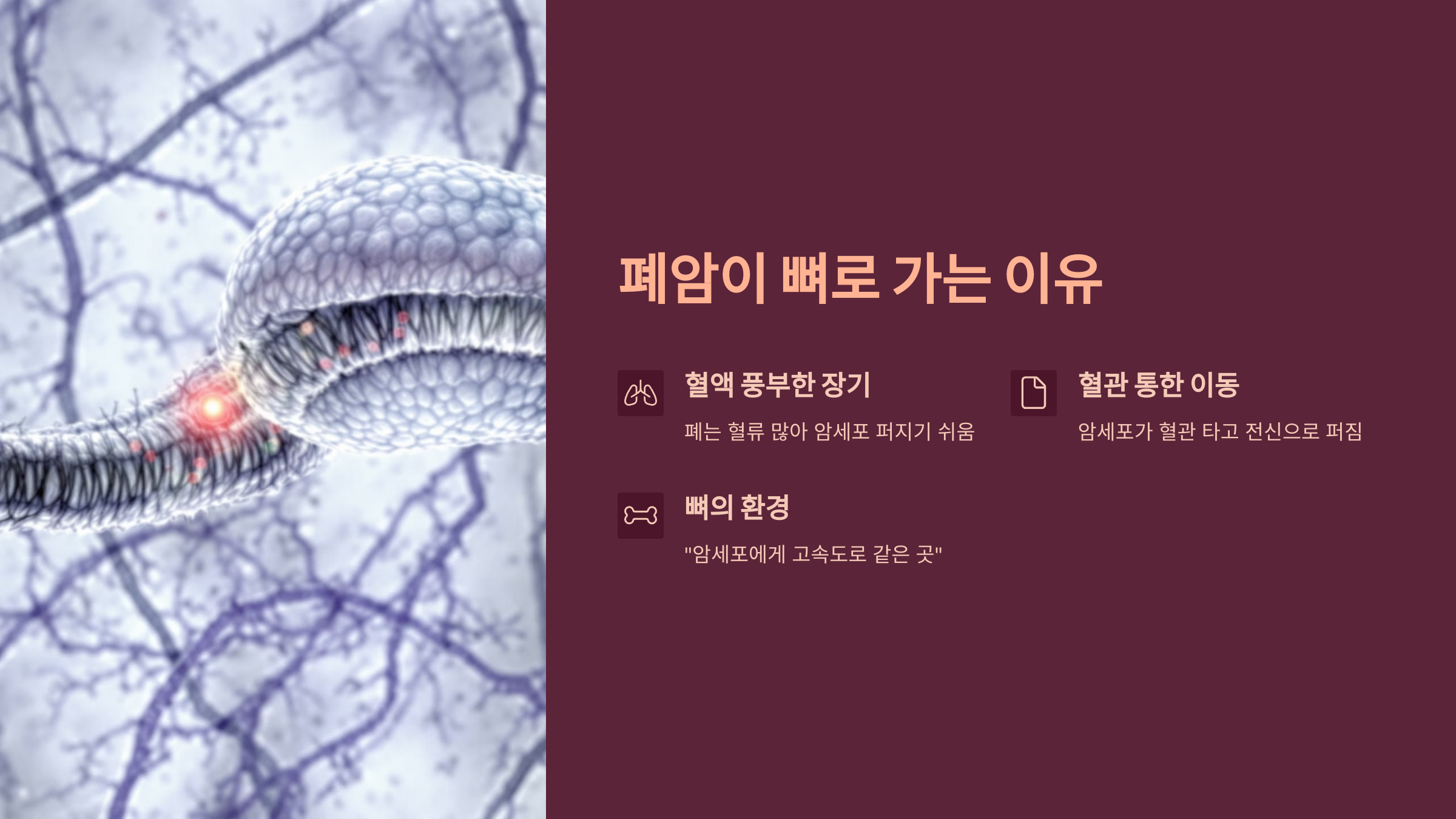 폐암이 뼈로 가는 이유