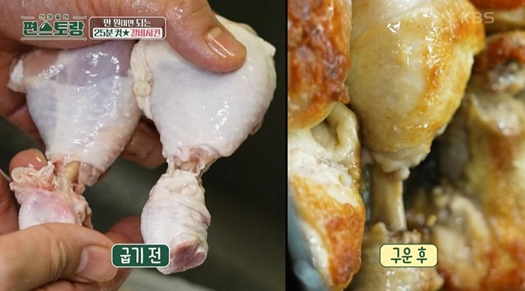 류수영 갈비치킨 아킬레스건 제거 이미지