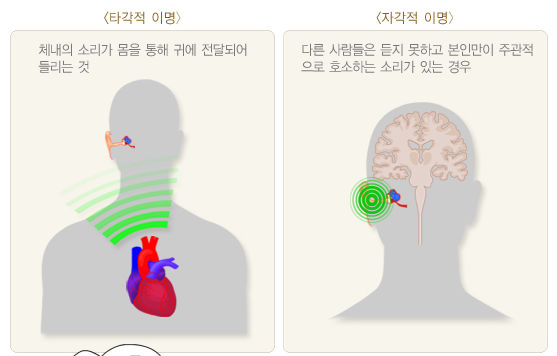 어지럽고 토할 것같은 증상