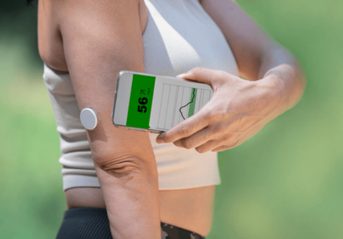 연속 혈당측정기의 특징