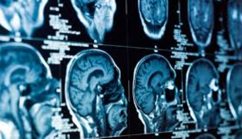 신경과 신경외과 차이