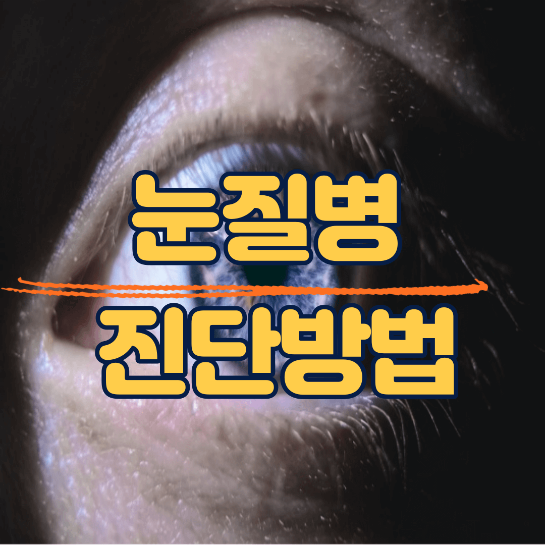 눈 통증 안과질환 예방법