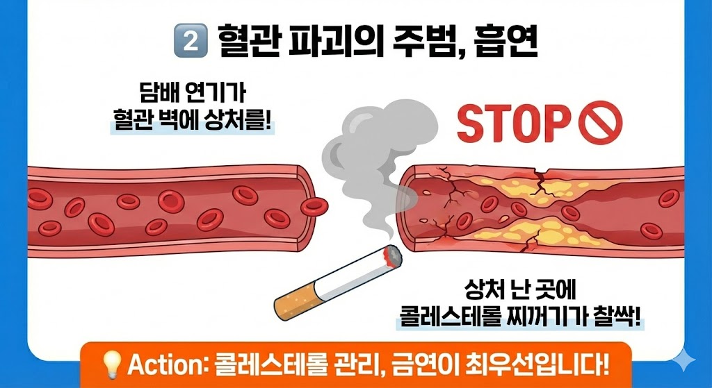 콜레스테롤 낮추는 방법