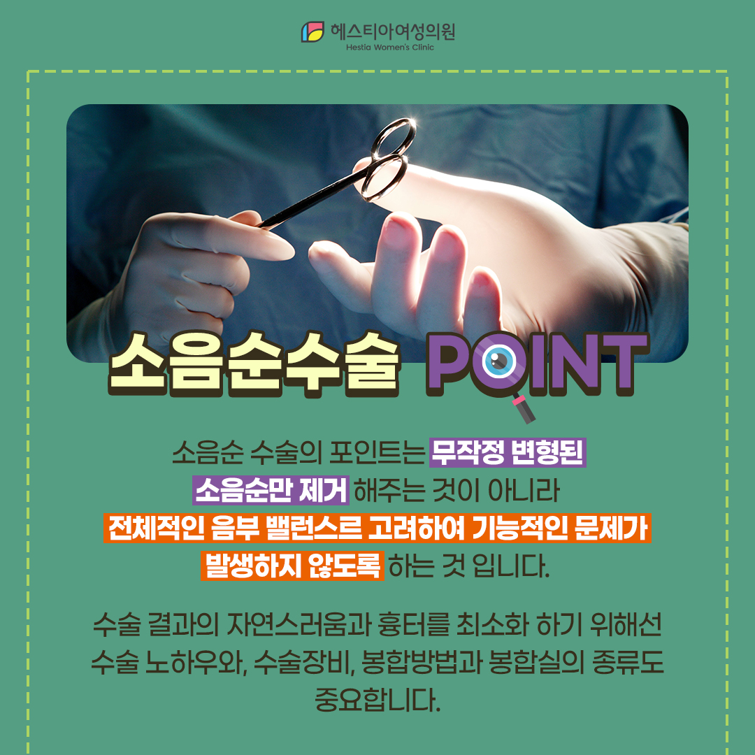 소음순수술 포인트