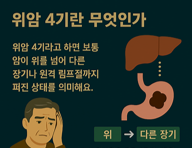 위암 4기란 무엇인가