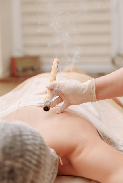 뜸과 침의 효과와 관련된 사진