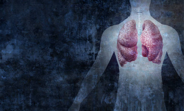 과탄산혈증(hypercapnia) 증상