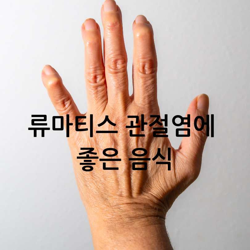 류마티스관절염 증상,식단,운동법