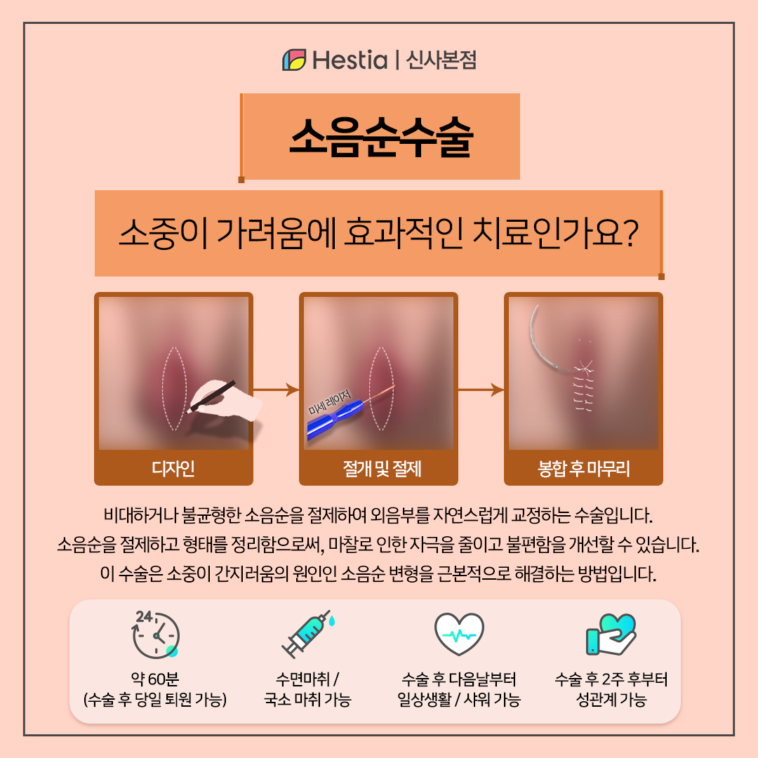 소음순수술, 소음순 가려움에 효과적인 해결책일까?