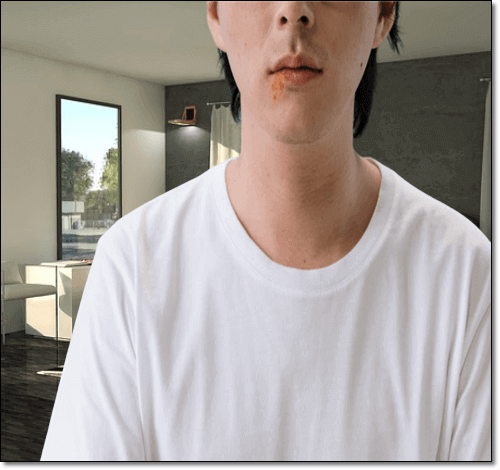 입술 포진이 생긴 남성