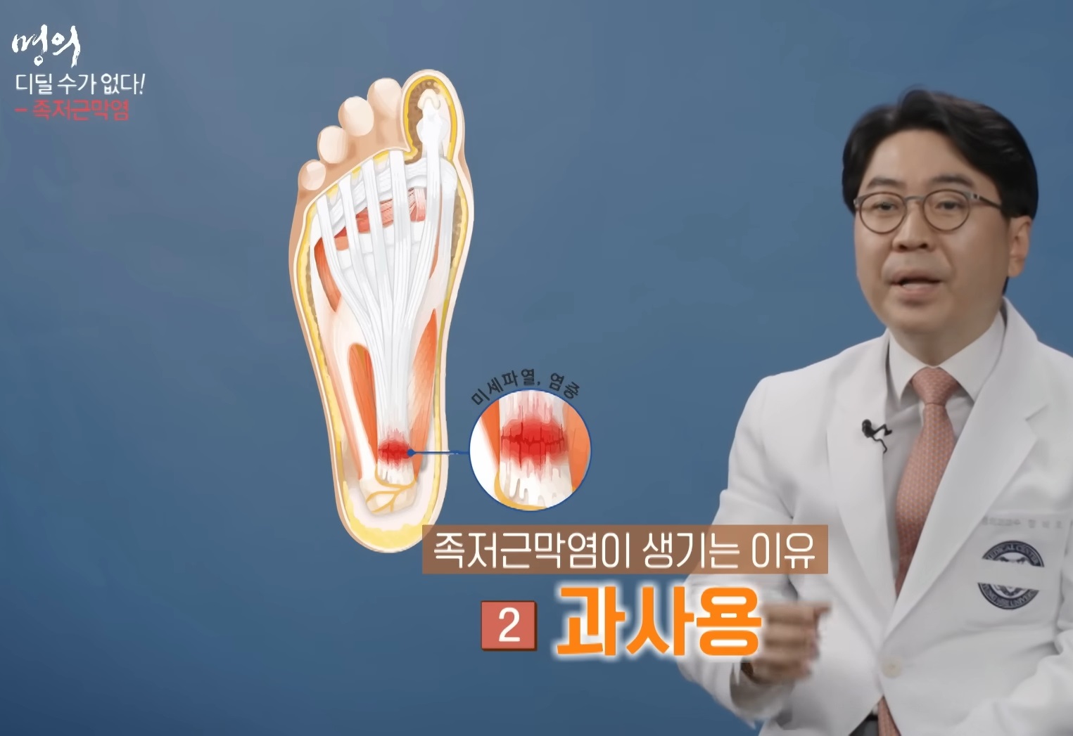 족저근막염-명의-최기원-교수