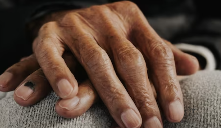 파킨스병의 흡연