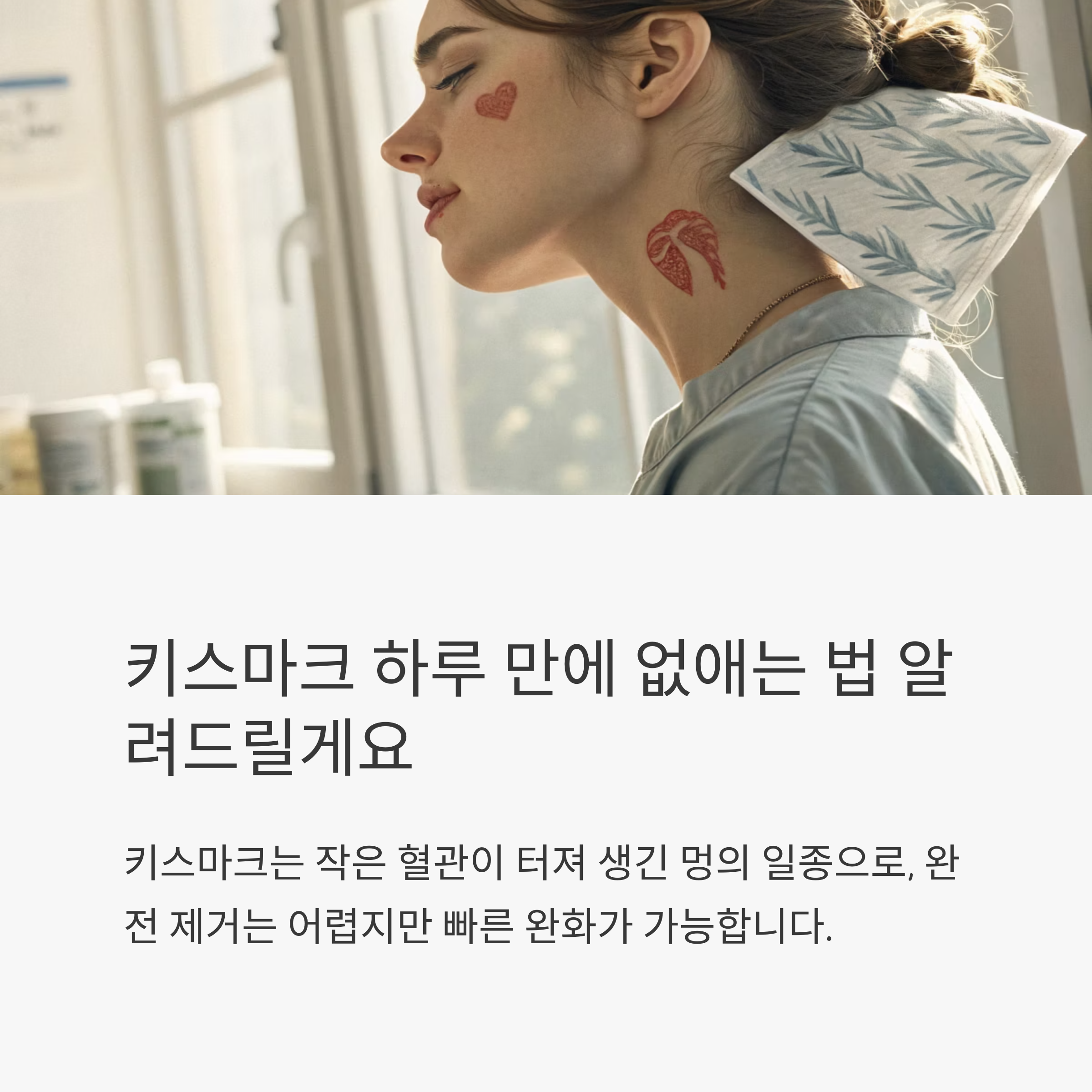 키스마크