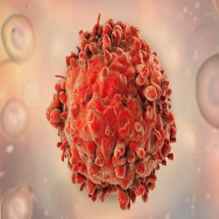 급성 백혈병 증상 5가지