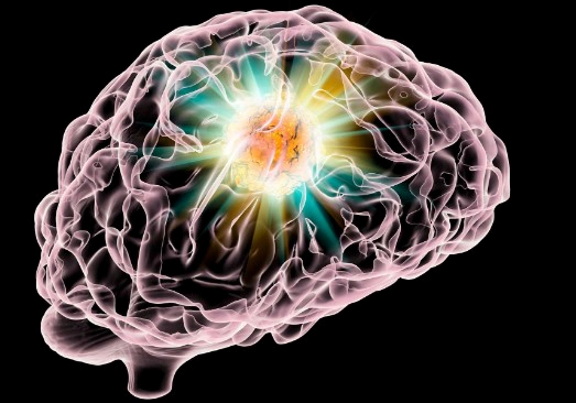 뇌암 초기증상 치료방법 및 김정화 남편 뇌암 사연