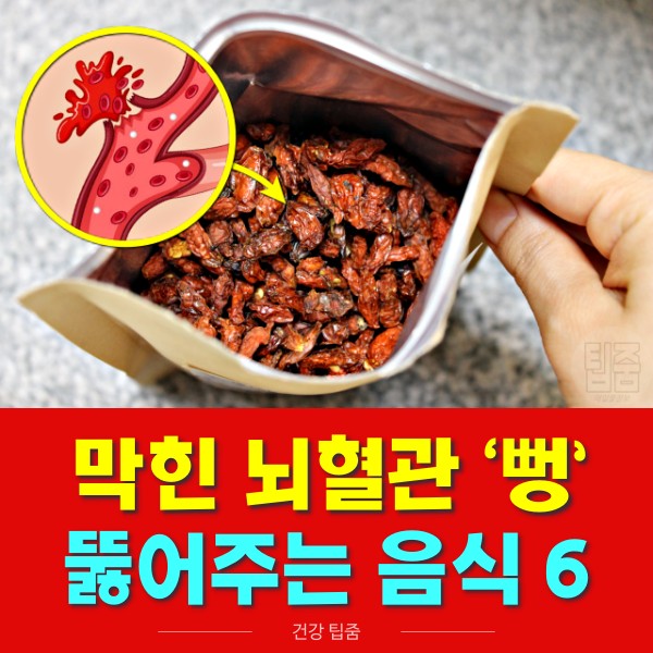 뇌혈관에 좋은 음식 구기자 효능 혈전에 좋은 음식, 건강 팁줌 매일꿀정보