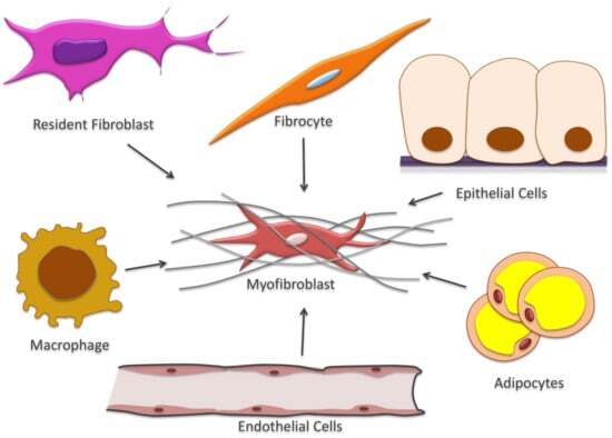 myofibroblast differentiation