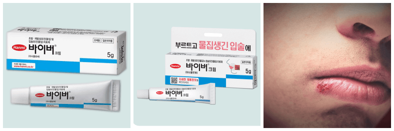 바이버크림, 입술포진 사진
