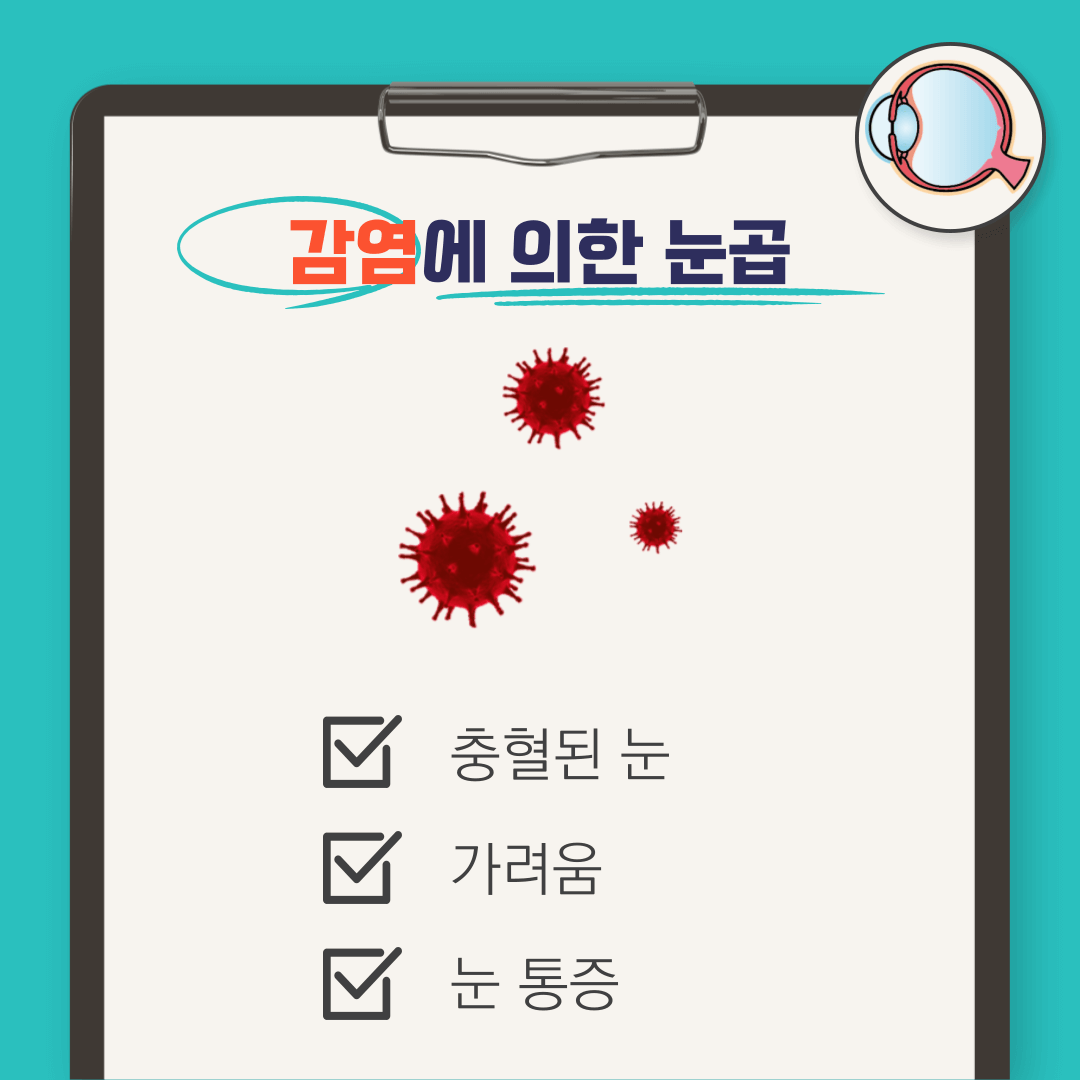 눈곱 끼는 이유: 눈곱 자주 끼는 이유