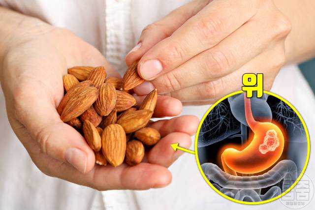최고의 건강식품 세계보건기구 좋은음식 아몬드 위암