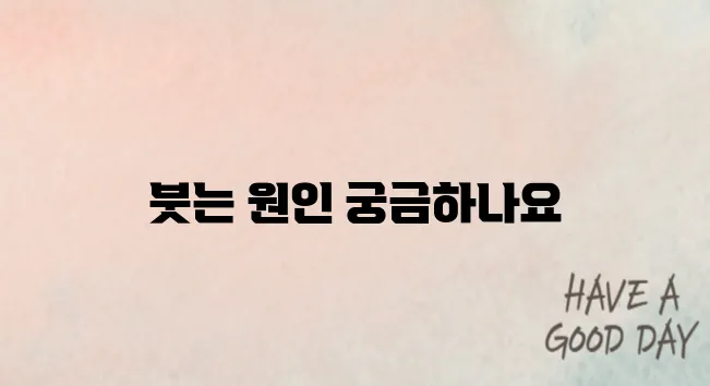 눈두덩이가 붓는 이유