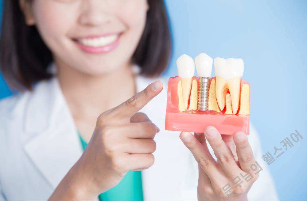 임플란트 시술 과정 기간 통증