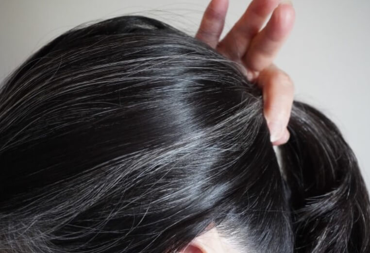 탈모 예방 혈자리