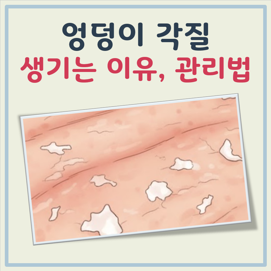 엉덩이 각질이 생기는 이유와 관리법 쉬운 정리 대표 이미지