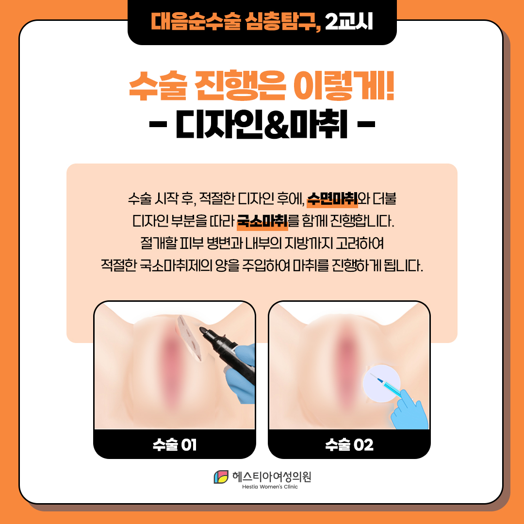 대음순수술 진행은 이렇게 진행돼요!