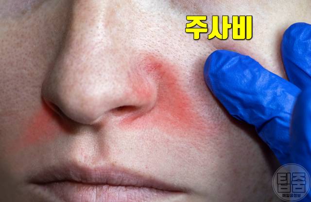 장 안좋을때 증상 장 안좋으면 여드름 주사비