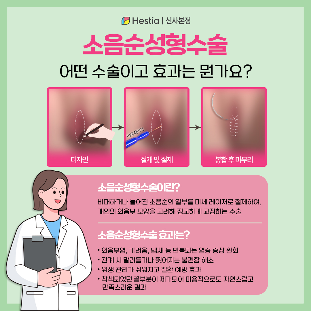 소음순성형수술, 어떤 효과가 있나요?
