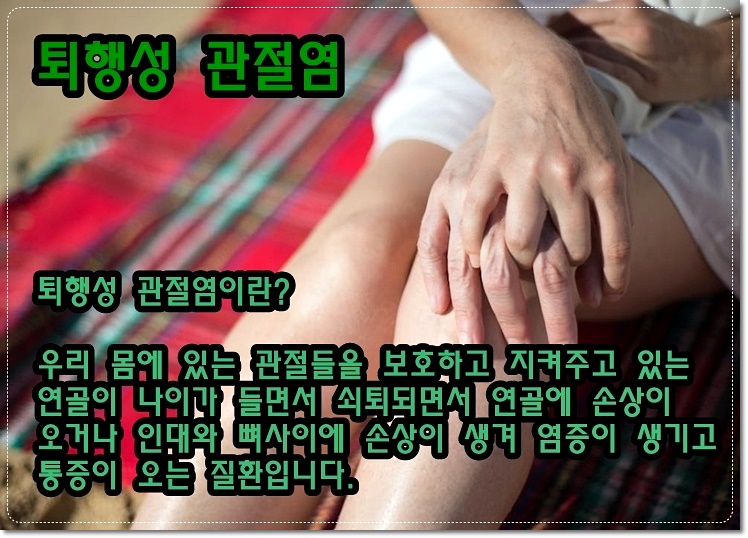 퇴행성 관절염