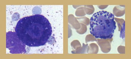 Basophil 수치