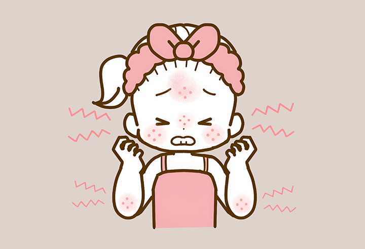 알레르기로-고통스러운-여성