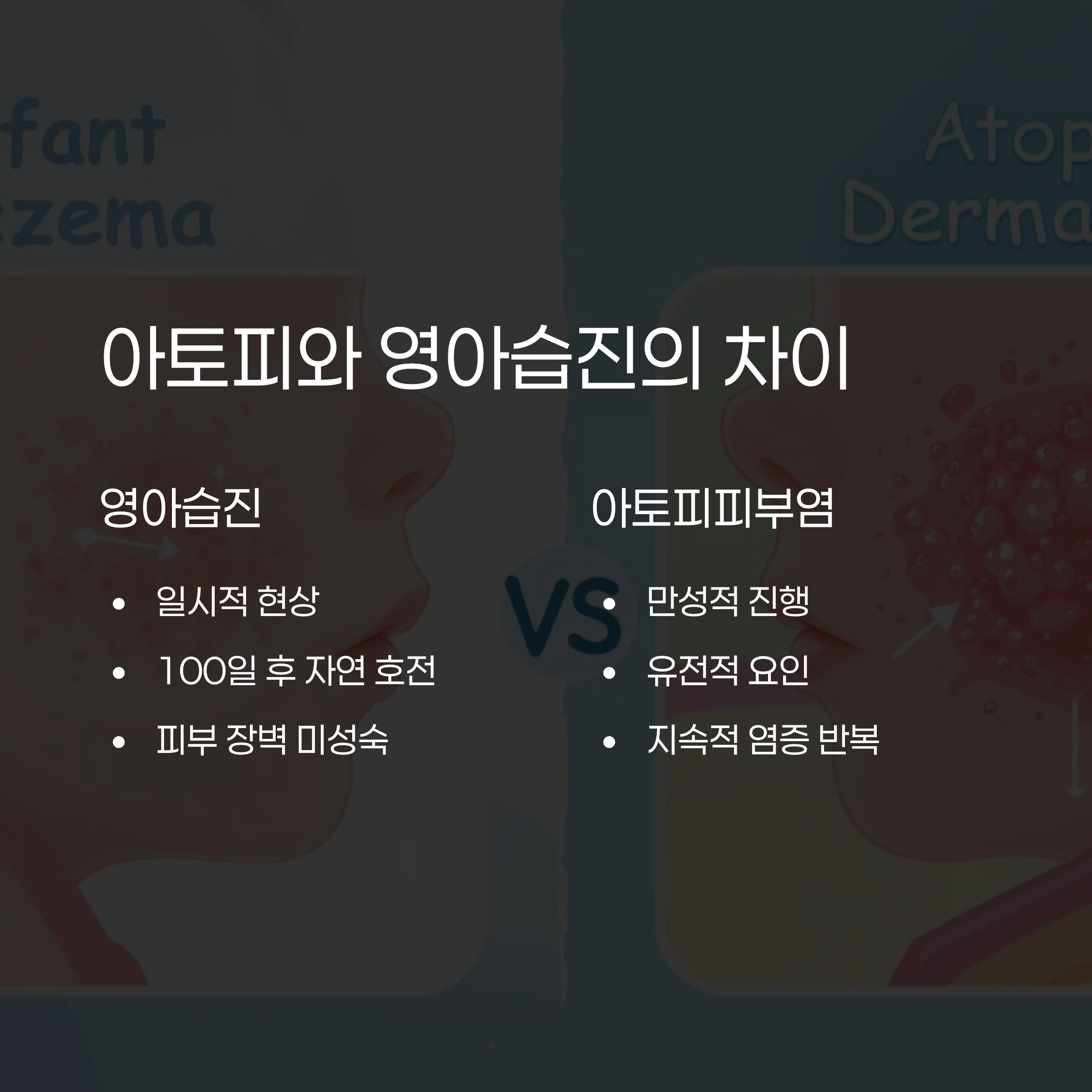 아토피피부염과 영아습진의 차이를 일시성과 만성성, 자연 호전 여부, 유전적 요인 등으로 비교한 인포그래픽 이미지